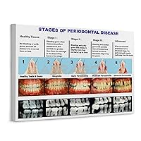 ABRAGO Stages of Periodontal Disease Dental Clinic Guide Poster Tooth Anatomy Poster (1) Wall Poster Art Canvas Printing Poster Office Bedroom Aesthetic Poster Unframe-style 10x8inch(25x20cm)