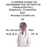 A Simple Guide To Degenerative Arthritis (Osteoarthritis) Diagnosis, Treatment And Related Conditions (A Simple Guide to Medical Conditions) A Simple Guide To Degenerative Arthritis (Osteoarthritis) Diagnosis, Treatment And Related Conditions (A Simple Guide to Medical Conditions) Kindle