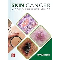 Skin Cancer: A Comprehensive Guide Skin Cancer: A Comprehensive Guide Kindle Hardcover