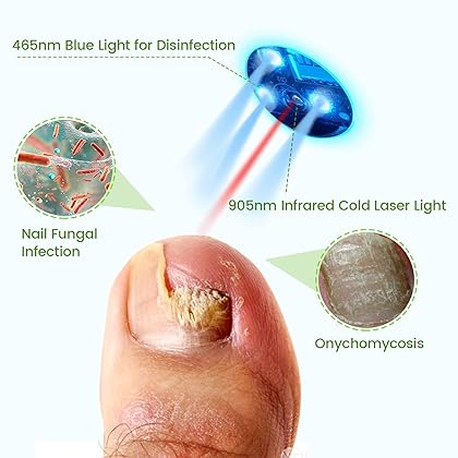 pinfriy Nail Fungus Cleaning Device Home Treatment for Toenail Fungus & Onychomycosis 905nm Infrared Light+ 470nm Blue Light