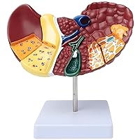 Human Anatomy Model, Human Anatomy Liver Model, Life Size Anatomy Liver Model with Base and Clear Texture and Pathological, Features Liver Cancer Model for Teaching Demonstration and Explanation