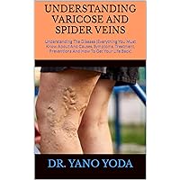 UNDERSTANDING VARICOSE AND SPIDER VEINS : Understanding The Disease (Everything You Must Know About And Causes, Symptoms, Treatment, Preventions And How To Get Your Life Back) UNDERSTANDING VARICOSE AND SPIDER VEINS : Understanding The Disease (Everything You Must Know About And Causes, Symptoms, Treatment, Preventions And How To Get Your Life Back) Kindle Paperback