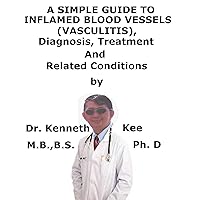 A Simple Guide To Inflamed Blood Vessels (Vasculitis), Diagnosis, Treatment And Related Conditions