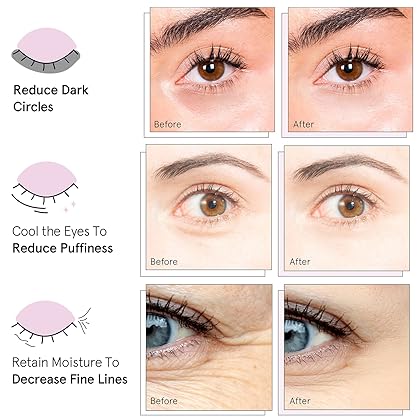 Under Eye Mask (Gold, 24 Pairs) Reduce Dark Circles, Puffy Eyes, Undereye Bags, Wrinkles - Gel Under Eye Patches, Vegan Cruelty-Free Self Care by grace and stella