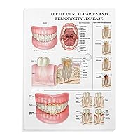CNNLOAO Dental Knowledge Poster Periodontal Disease Poster Stages Retro Poster (11) Canvas Poster Bedroom Decor Office Room Decor Gift Unframe-style 12x16inch(30x40cm)
