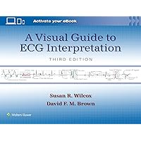 A Visual Guide to ECG Interpretation: Print + eBook with Multimedia A Visual Guide to ECG Interpretation: Print + eBook with Multimedia Paperback Kindle