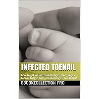 Infected Toenail: how to get rid of toenail fungus, foot fungus, toenail fungus cure, toenail fungus, nail fungus Infected Toenail: how to get rid of toenail fungus, foot fungus, toenail fungus cure, toenail fungus, nail fungus Kindle