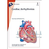 Fast Facts: Cardiac Arrhythmias Fast Facts: Cardiac Arrhythmias Kindle Paperback