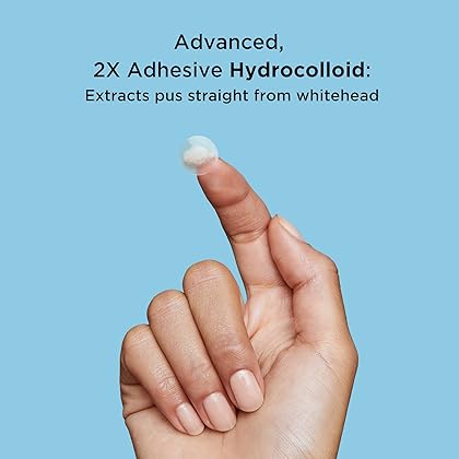 Avarelle Pimple Patches (40 Count) Hydrocolloid Acne Cover Patches | Zit Patches for Blemishes, Zits and Breakouts with Tea Tree, Calendula and Cica Oil for Face | Vegan, Cruelty Free Certified, Carbonfree Certified (40 PATCHES)