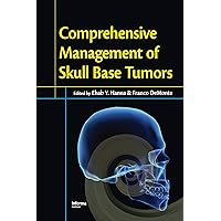 Comprehensive Management of Skull Base Tumors Comprehensive Management of Skull Base Tumors Hardcover