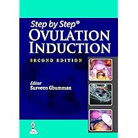 Step by Step Ovulation Induction Step by Step Ovulation Induction Kindle Paperback