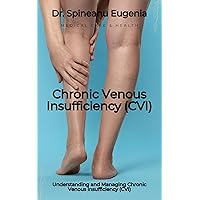 Understanding and Managing Chronic Venous Insufficiency (CVI) Understanding and Managing Chronic Venous Insufficiency (CVI) Kindle Paperback