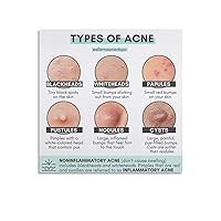ESyem Beauty Salon Poster Different Types of Acne Care Poster Skin Health Poster Canvas Wall Art Prints for Wall Decor Room Decor Bedroom Decor Gifts Posters 28x28inch(70x70cm) Unframe-style