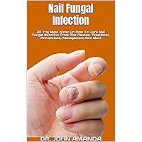 Nail Fungal Infection : All You Must Know On How To Cure Nail Fungal Infection From The Causes, Treatment, Preventions, Management And More Nail Fungal Infection : All You Must Know On How To Cure Nail Fungal Infection From The Causes, Treatment, Preventions, Management And More Kindle