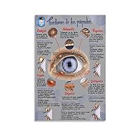 RCIDOS Eye Office Poster Eyelid Disease Guide Art Poster Eyeglass Disease Poster Canvas Painting Posters And Prints Wall Art Pictures for Living Room Bedroom Decor 08x12inch(20x30cm) Unframe-style