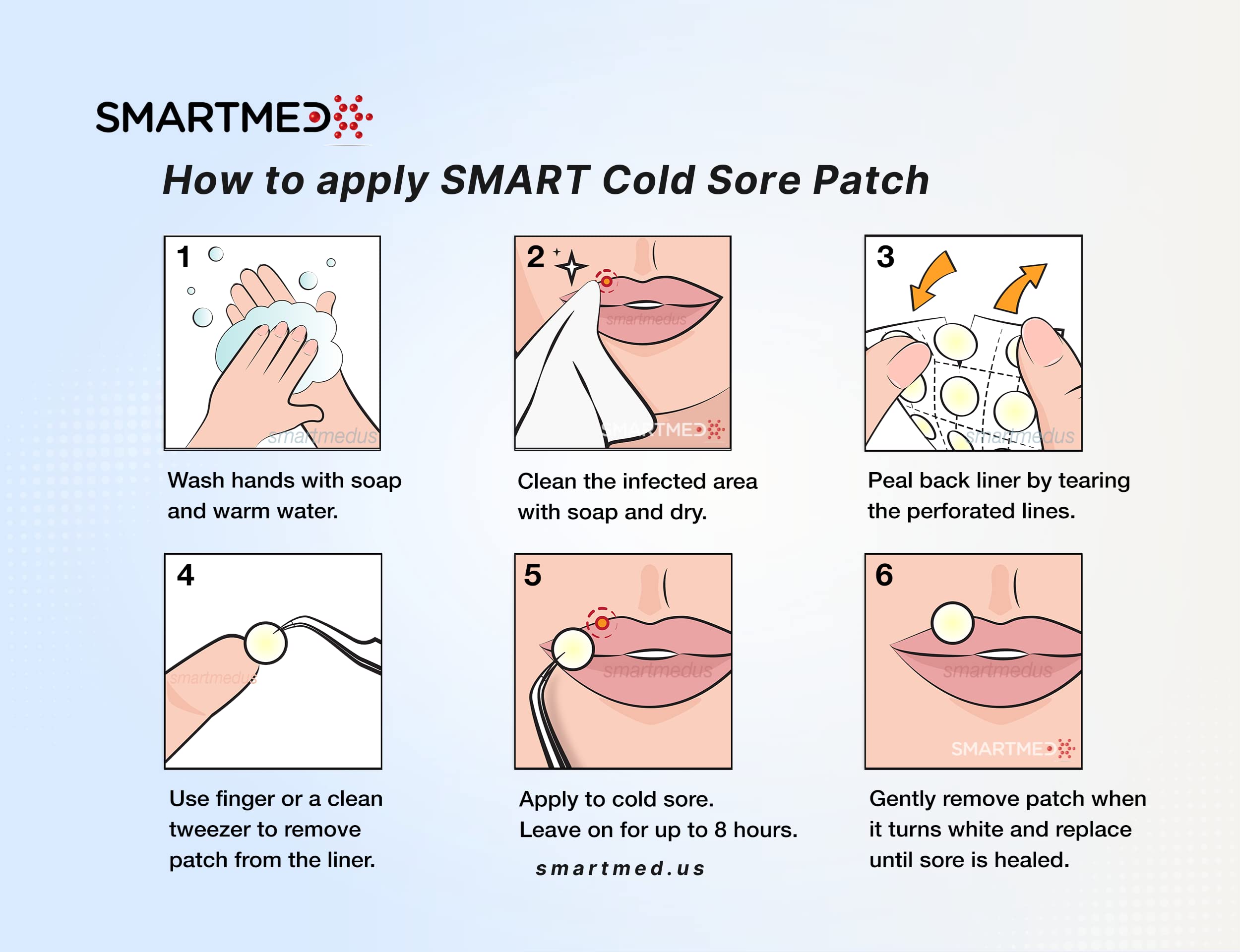 SMARTMED Smart Cold Sore Treatment Patch Help Prevent Breakouts, Soothe Itching and Burning | Discrete, Invisible, Skin Safe Adhesive [24 Patches]