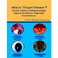 What is “Tangier Disease”?: Causes, History, Pathophysiology, Signs & Symptoms, Diagnosis, Treatment etc. What is “Tangier Disease”?: Causes, History, Pathophysiology, Signs & Symptoms, Diagnosis, Treatment etc. Kindle