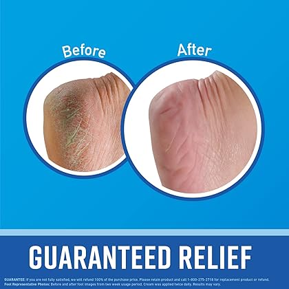 O'Keeffe's for Healthy Feet Foot Cream, Guaranteed Relief for Extremely Dry, Cracked Feet, Clinically Proven to Instantly Boost Moisture Levels, 3.0 Ounce Tube, (Pack of 2)