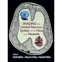 Imaging the Central Nervous System of the Fetus and Neonate Imaging the Central Nervous System of the Fetus and Neonate Hardcover