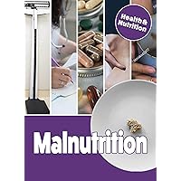 Malnutrition (Health & Nutrition) Malnutrition (Health & Nutrition) Library Binding