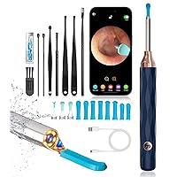 Ear Wax Removal, Ear Wax Removal Tool Camera with 6 Spoons, Ear Cleaner with Camera, 1080P Ear Scope, Earwax Removal Kit with with 6 LED Light