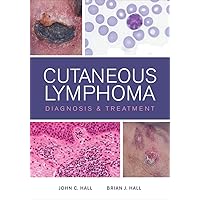 Cutaneous Lymphoma: Diagnosis and Treatment Cutaneous Lymphoma: Diagnosis and Treatment Kindle Hardcover