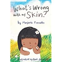What's Wrong with my Skin? What's Wrong with my Skin? Kindle Paperback