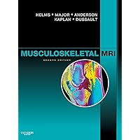 Musculoskeletal MRI Musculoskeletal MRI Hardcover