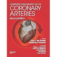 Computed Tomography of the Coronary Arteries Computed Tomography of the Coronary Arteries Kindle Hardcover Paperback