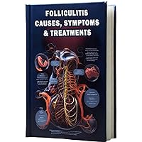 Folliculitis Causes, Symptoms & Treatments: Understand the causes, symptoms, and available treatments for folliculitis, a common skin condition. Folliculitis Causes, Symptoms & Treatments: Understand the causes, symptoms, and available treatments for folliculitis, a common skin condition. Paperback