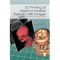 3D Printing of Medical Models from CT-MRI Images 3D Printing of Medical Models from CT-MRI Images Paperback Kindle Hardcover