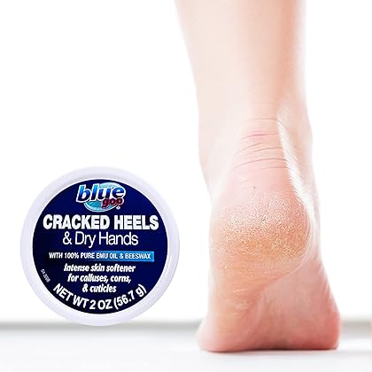 BLUE GOO Cracked Heels & Dry Hands Skin Softener for Dry Feet, Hands, Hydrating and Smoothing, Moisturizer, Dryness Relief, 2 Ounce, Made with 100% Pure EMU Oil