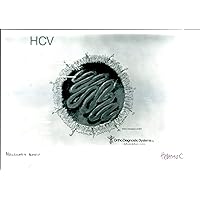 Hepatitis C - Vintage Press Photo