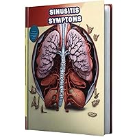 Sinusitis Symptoms: Learn about the symptoms of sinusitis, an inflammation of the sinuses causing discomfort and congestion. Sinusitis Symptoms: Learn about the symptoms of sinusitis, an inflammation of the sinuses causing discomfort and congestion. Paperback
