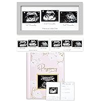 KeaBabies Sonogram Picture Frame and Pregnancy Journal, Pregnancy Announcements - Trio Ultrasound Picture Frames For Mom To Be Gift - 80 Pages Hard Cover Pregnancy Book For Mom To Be Gift