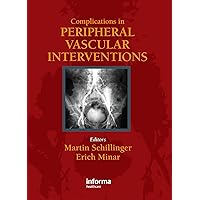 Complicatons in Peripheral Vascular Interventions Complicatons in Peripheral Vascular Interventions Kindle Hardcover