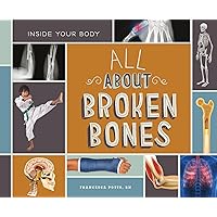 All About Broken Bones (Inside Your Body)