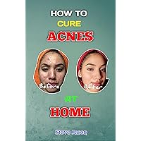 How To Cure Acne At Home