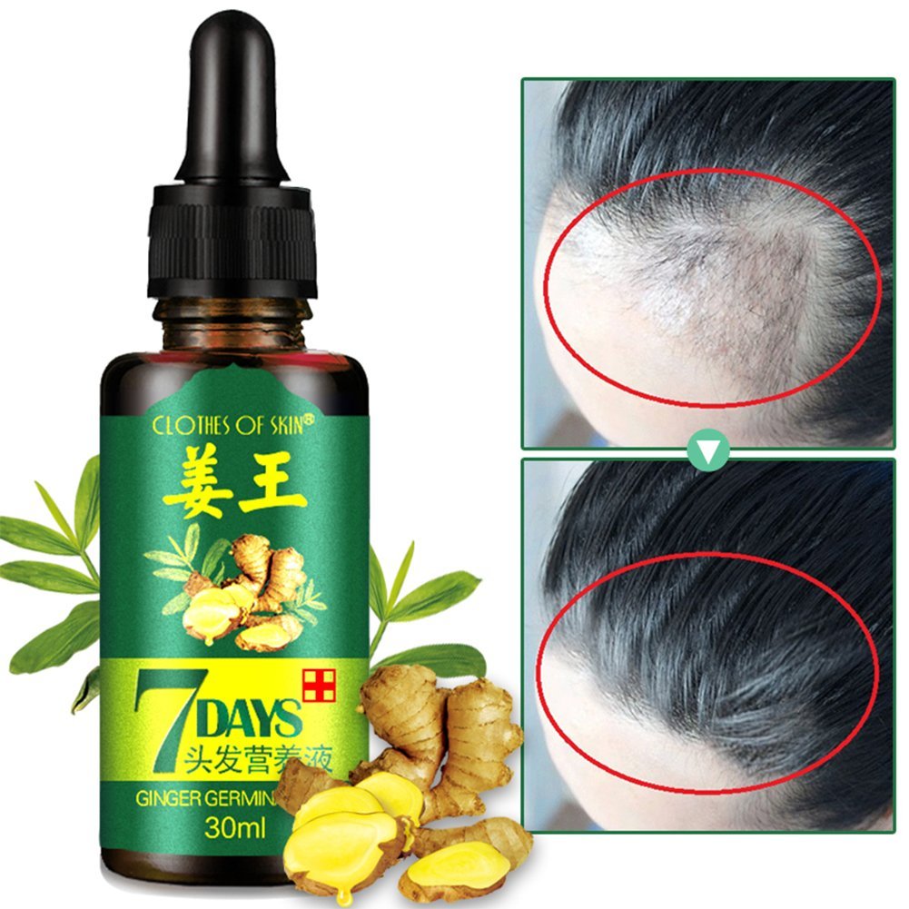 Mua Ginger Germinal Oil,2020 Hair Growth Ginger Essential Oil Hair Growth  Hair Loss Treatment Hair Growth Serum for Men and Women trên Amazon Mỹ  chính hãng 2023 | Fado