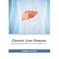 Chronic Liver Disease: Causes, Evaluation and Therapeutics