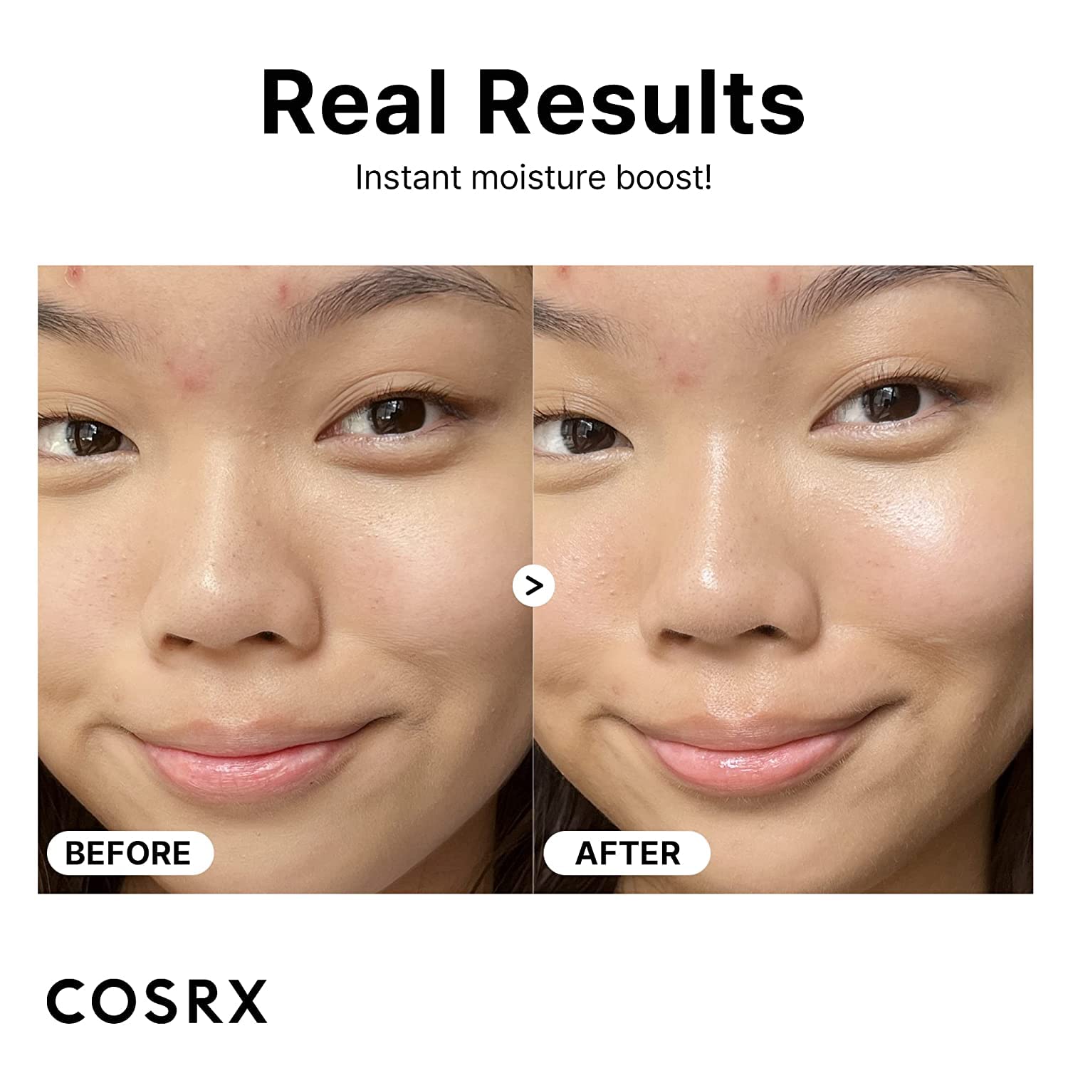 COSRX Hyaluronic Acid Hydrating Duo- Hyaluronic Acid Intensive Cream + Hyaluronic Acid 3% Serum, Deep Hydration, Retain Moisture, Easy and Daily Skincare, Korean SKincare