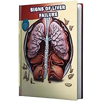 Signs of Liver Failure: Recognize the signs of liver failure and the importance of liver health for overall well-being. Signs of Liver Failure: Recognize the signs of liver failure and the importance of liver health for overall well-being. Paperback