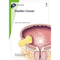 Fast Facts: Bladder Cancer Fast Facts: Bladder Cancer Kindle