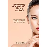 BEYOND ACNE: Transforming Your Skin And Your Life (Your Best Life: A Health Classic Series) BEYOND ACNE: Transforming Your Skin And Your Life (Your Best Life: A Health Classic Series) Kindle Hardcover Paperback