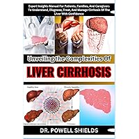 Unveiling The Complexities Of LIVER CIRRHOSIS: Expert Insights Manual For Patients, Families, And Caregivers To Understand, Diagnose, Treat, And Manage Cirrhosis Of The Liver With Confidence Unveiling The Complexities Of LIVER CIRRHOSIS: Expert Insights Manual For Patients, Families, And Caregivers To Understand, Diagnose, Treat, And Manage Cirrhosis Of The Liver With Confidence Paperback Kindle