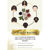 Stages of Balding Treatment: 100% Natural Hair Loss Treatment For Men & Women Stages of Balding Treatment: 100% Natural Hair Loss Treatment For Men & Women Kindle Paperback