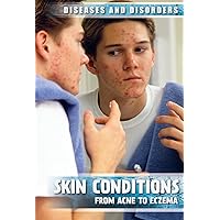 Skin Conditions: From Acne to Eczema (Diseases and Disorders) Skin Conditions: From Acne to Eczema (Diseases and Disorders) Library Binding Paperback