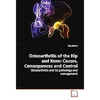 Osteoarthritis of the Hip and Knee: Causes, Consequences and Control: Osteoarthritis and its pathology and management Osteoarthritis of the Hip and Knee: Causes, Consequences and Control: Osteoarthritis and its pathology and management Paperback