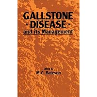 Gallstone Disease and its Management Gallstone Disease and its Management Kindle Paperback Hardcover