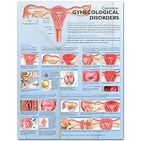 Common Gynecological Disorders Anatomical Chart Common Gynecological Disorders Anatomical Chart Wall Chart